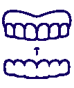 Invisalign/Clear Aligners