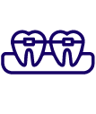Braces