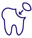 Dental Bonding