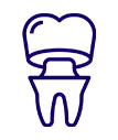 Dental Crowns & Bridges