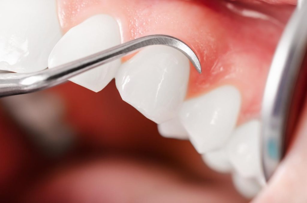 Gum Health & Your Whole Body: Why Healthy Gums Matter in 2026
